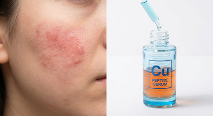 Copper peptides skin damage